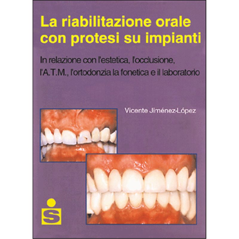 La riabilitazione orale con protesi su impianti.